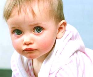 宝宝眼屎多的原因有哪些